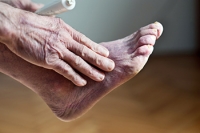 When Poor Circulation Hurts