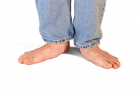 Dealing With Overpronation of the Feet