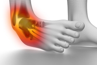 Grades and Types of Ankle Sprains