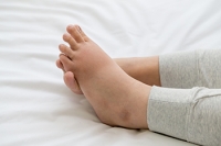 Various Reasons Why Feet Can Become Swollen